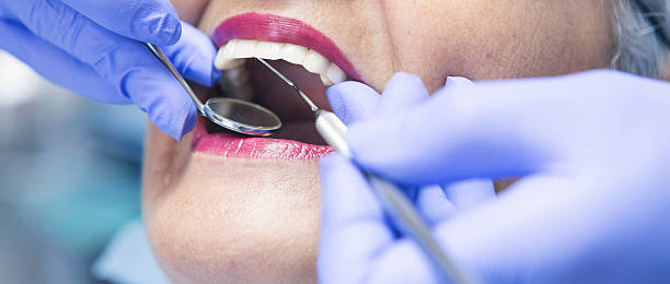 Best Emergency Root Canal Therapy in Granite Falls, NC
